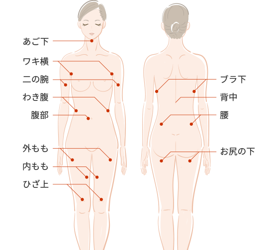 脂肪冷却痩身の適応部位