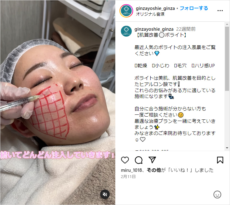 銀座よしえクリニック　インスタグラム